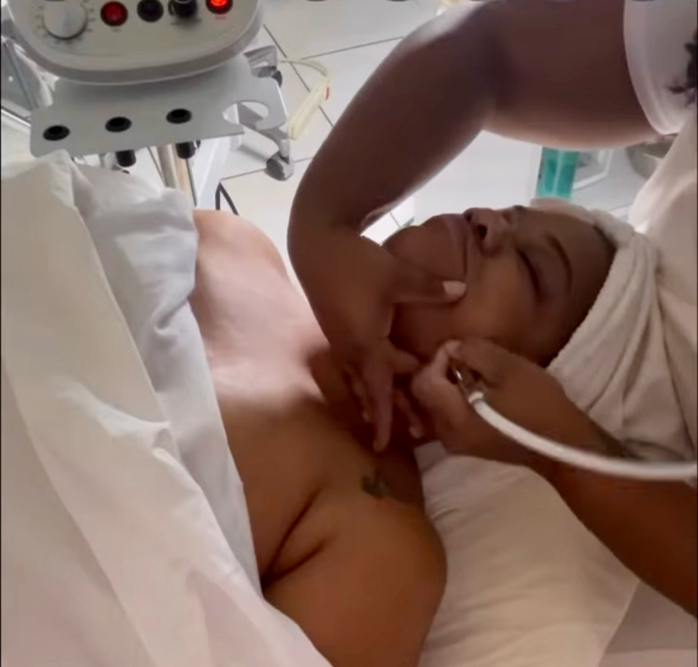 Microdermabrasion Facial