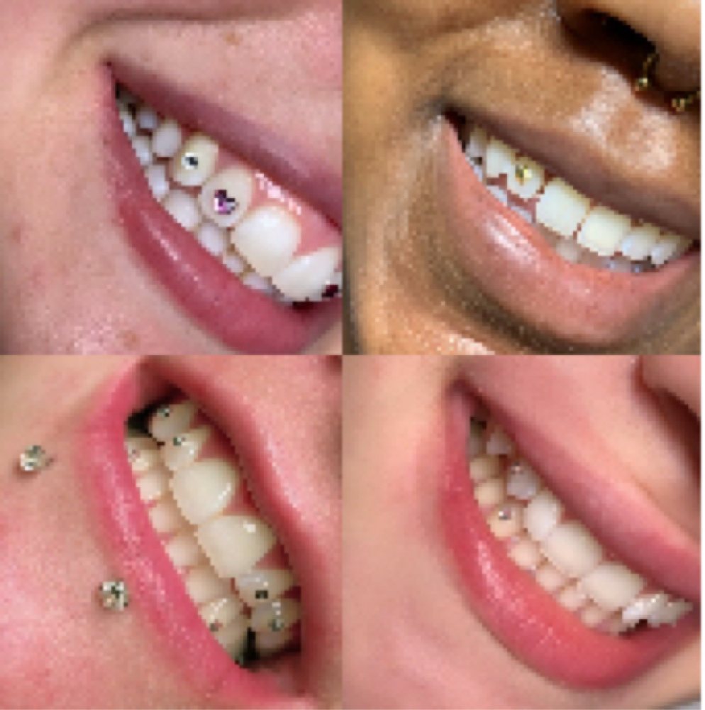 Tooth Gems (2 gems) at Culture Aesthetics in Orange City, FL