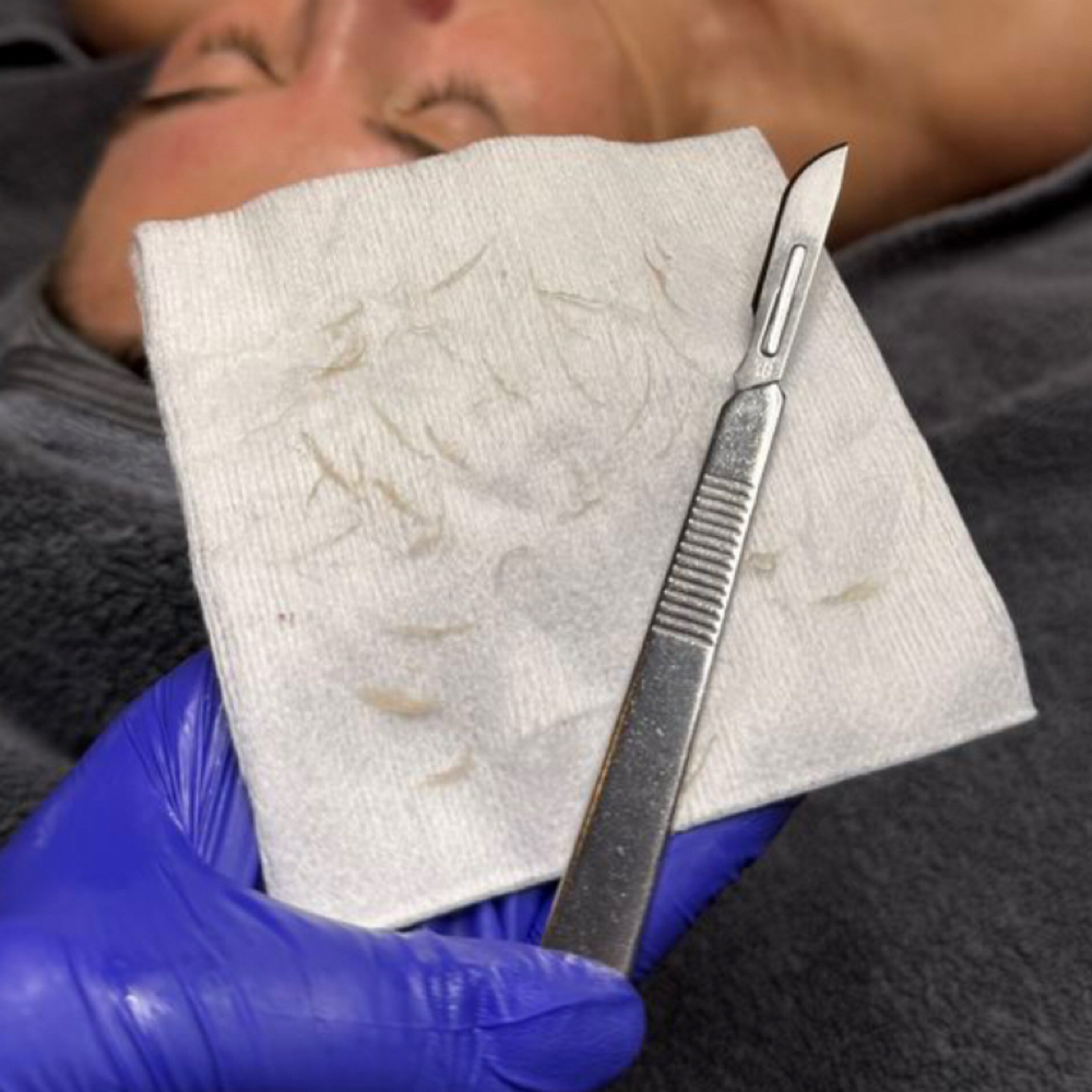 Add On+ Dermaplain at Mia.skintechh in Terrell, TX