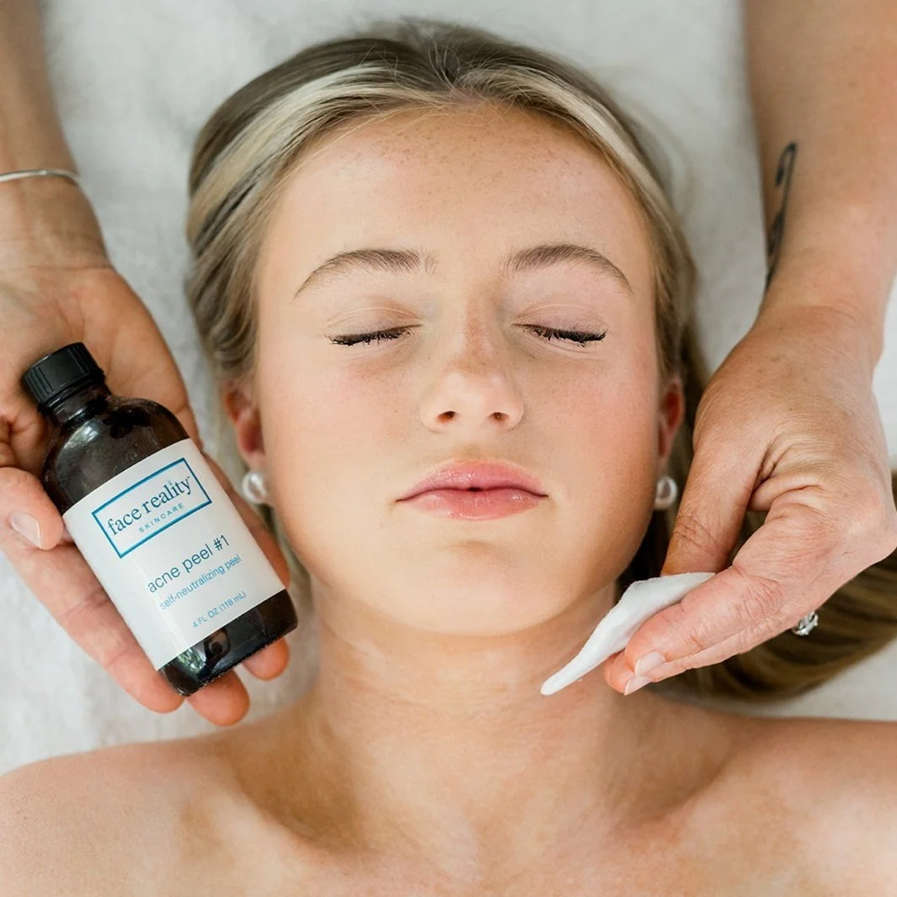 Clear Skin Peel For Face Treatment at The Glow Room, LLC in Lawrenceburg, KY