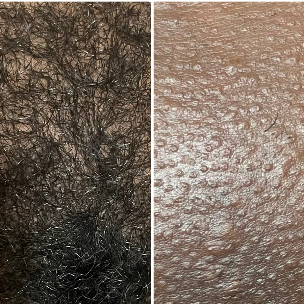 Brazilian wax FRONT ONLY