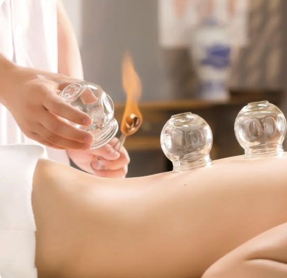 Cupping Therapy
