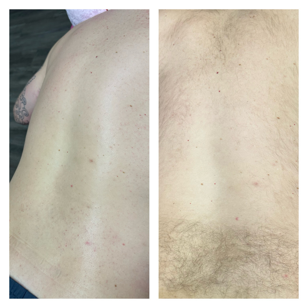 Men's Back Sugaring at Blooming Beauties Co. in Huntsville, AL