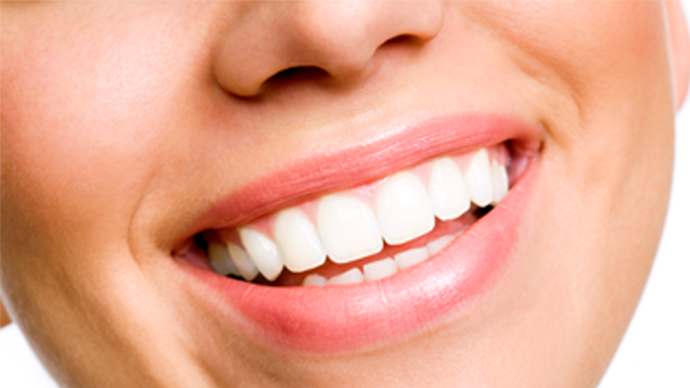 Say Cheese - Teeth