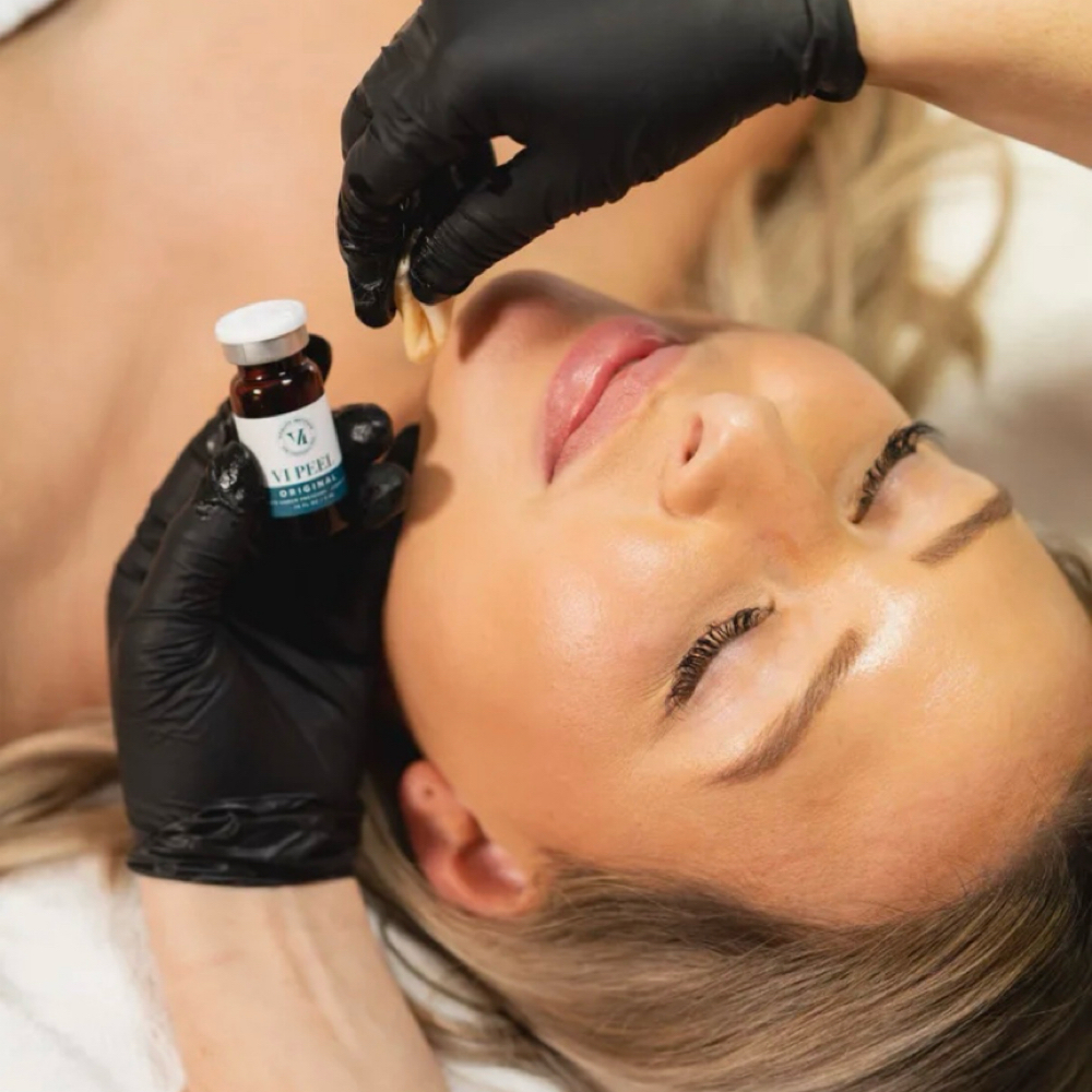 VI Peel at Nurse Lab Aesthetics & Wellness in Mission, TX