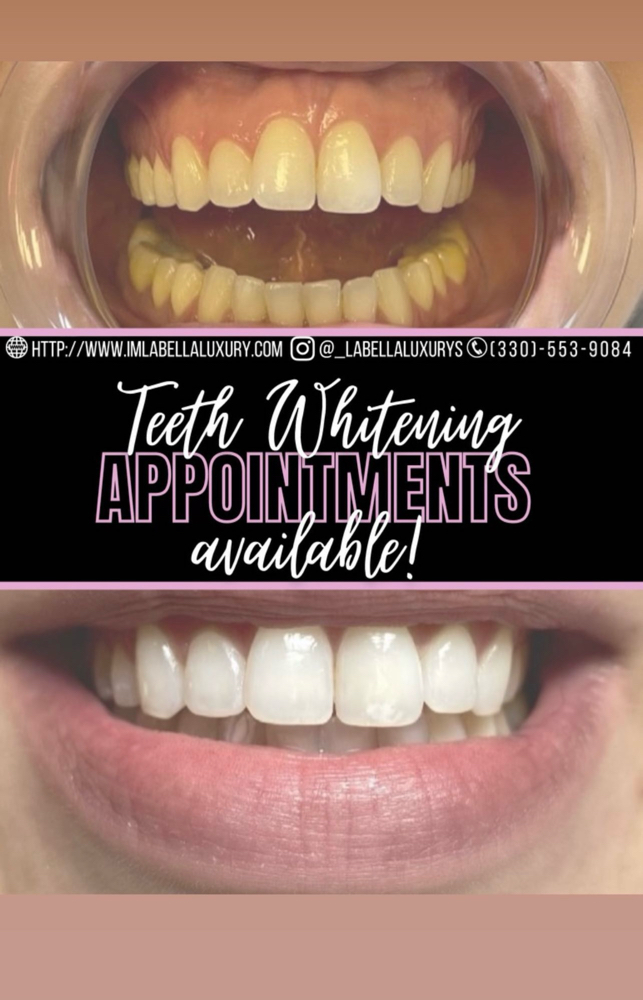 Express Teeth Whitening