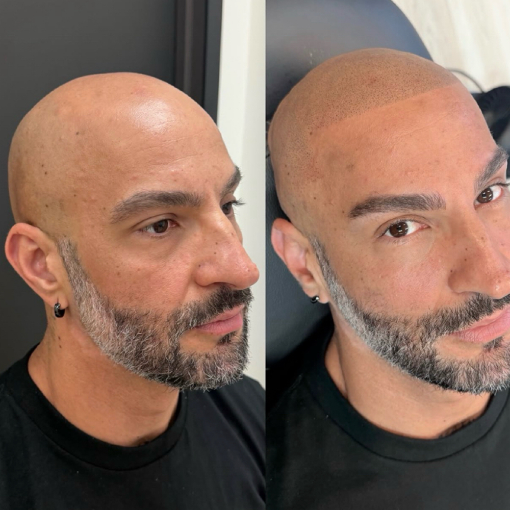 Hair loss Assessment Consultation at CutzStudio59 in New York, NY