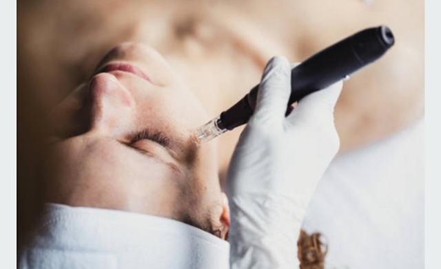 Microneedling Package
