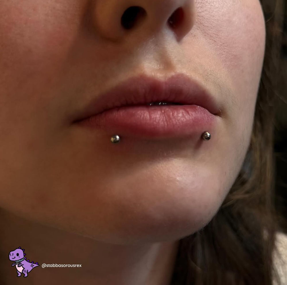 Snake Bites
