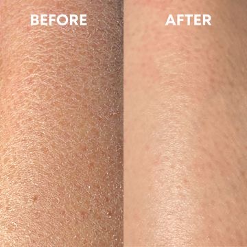 Full Body Exfoliation