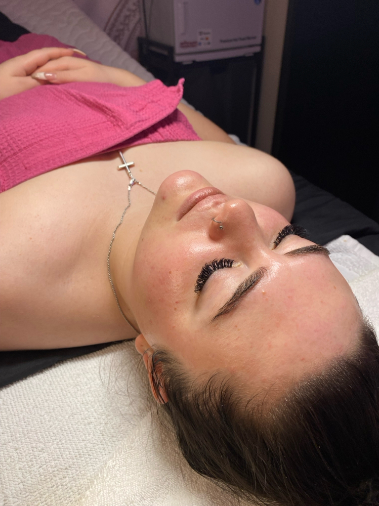 Glass Carboxy CO₂ Facial