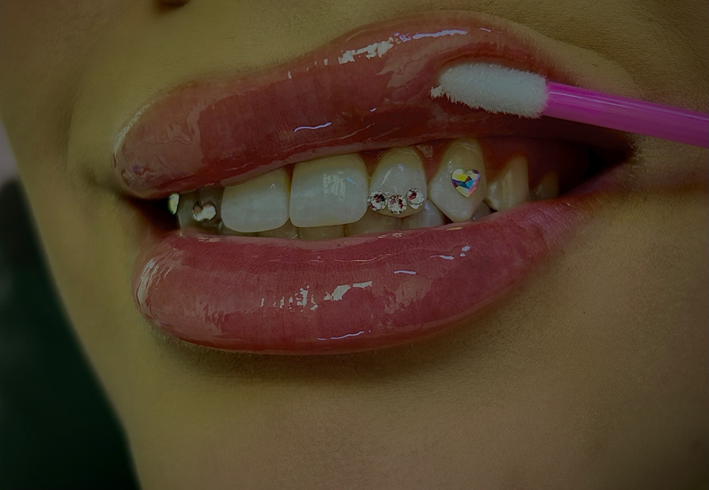Tooth Gem