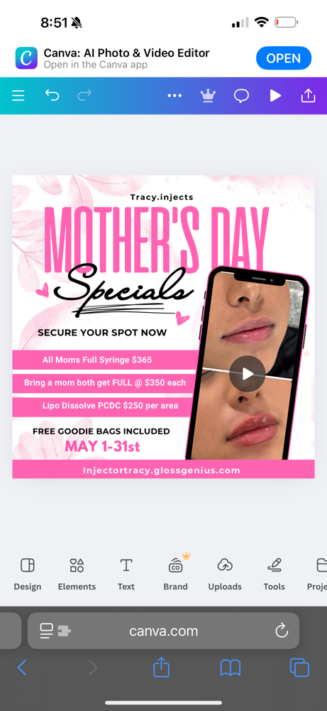 MOTHERS DAY SPECIAL -LIP FILLER