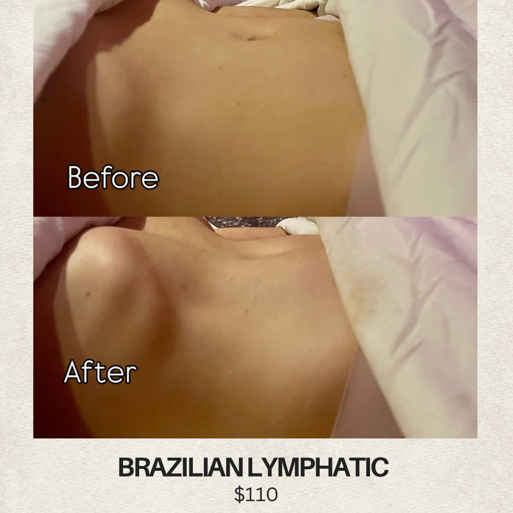 Brazilian Lymphatic