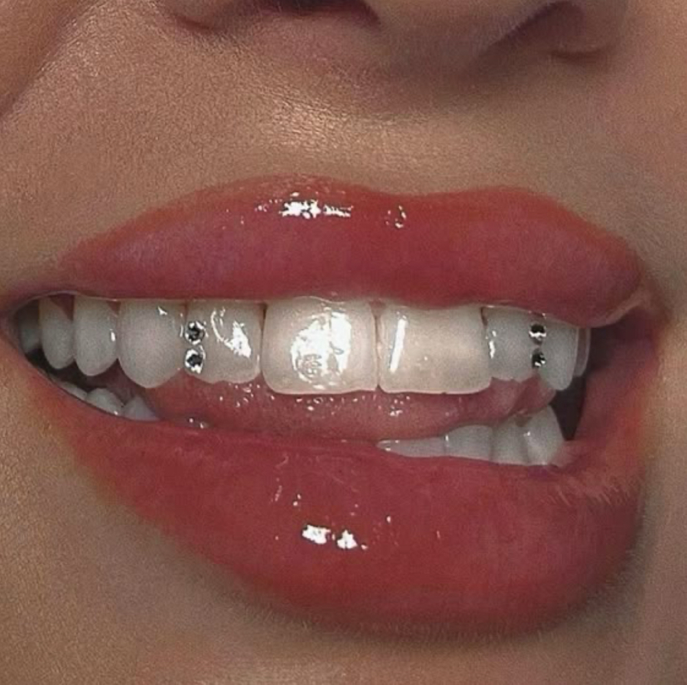 Tooth Gems