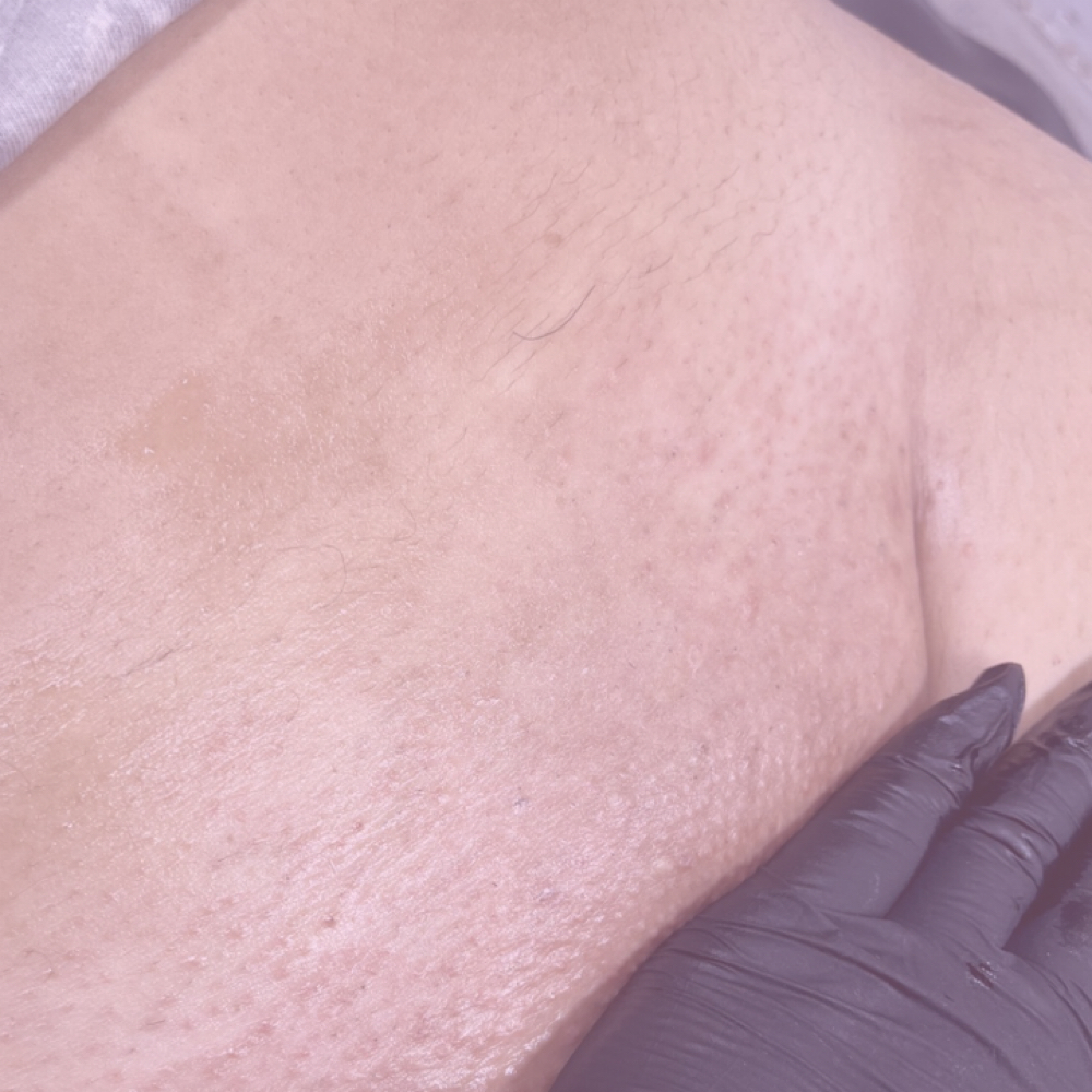 Brazilian Wax at Tales of Beauty Studio in Hurst, TX