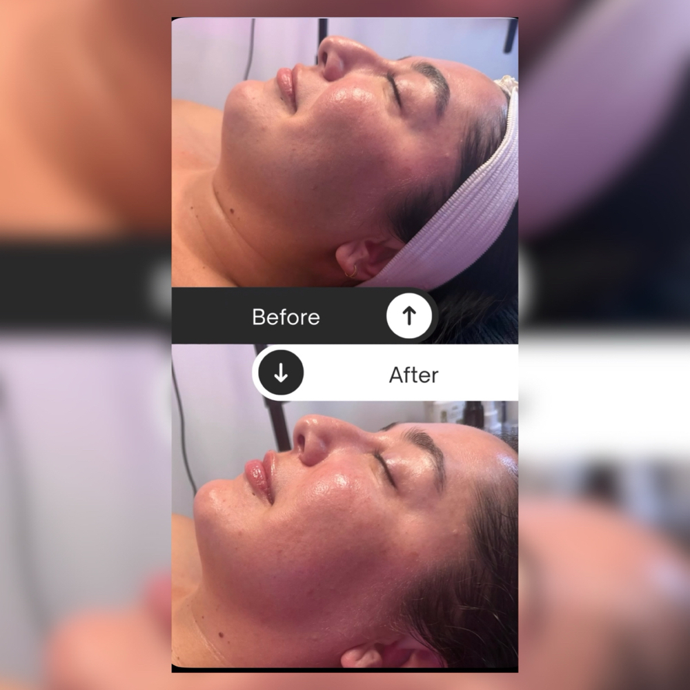 Express Facial Lymph Drain & Sculpt