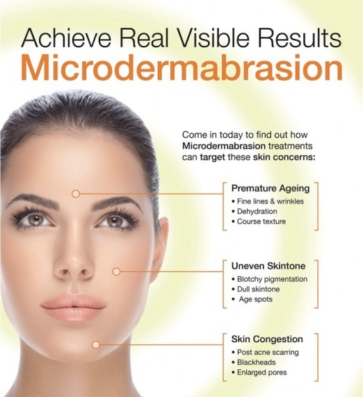 *Diamond* Microderm Glow