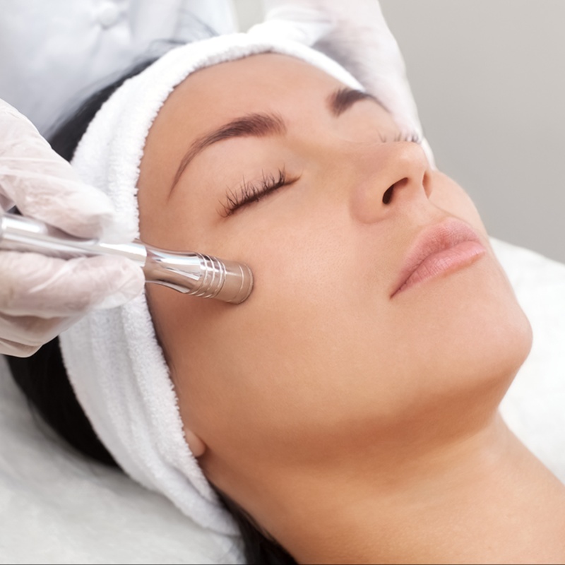 Micro-Derm Treatment (Add-On) at Skin Rescue Esthetics and Wellness (In-Home Services)