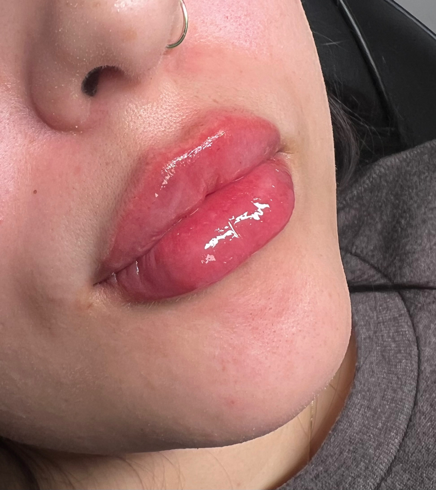 Full Lip Plump at The Tox Haus in Terrell, TX