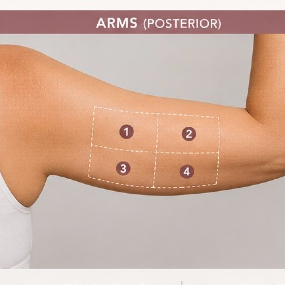 PCDC- Arms/Brazos at Lumé Aesthetics in Pharr, TX