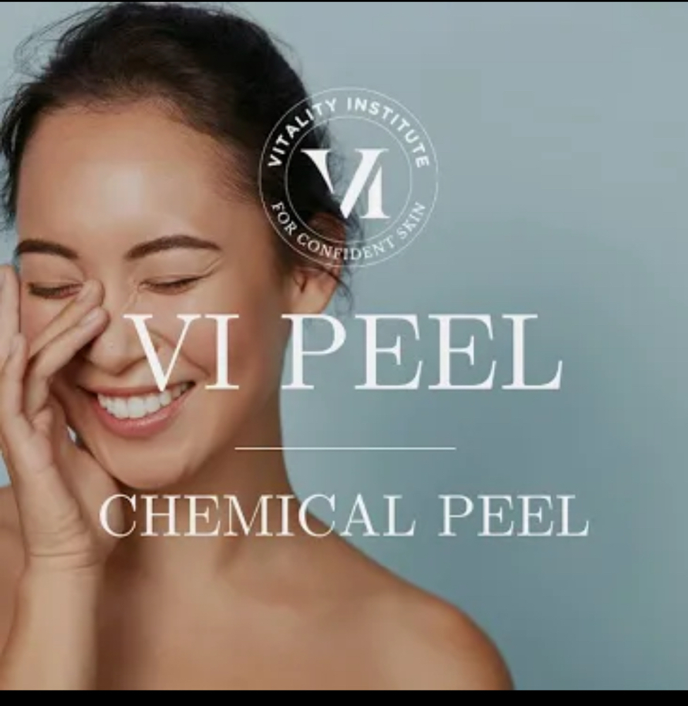 Chemical Peel (VI peel)