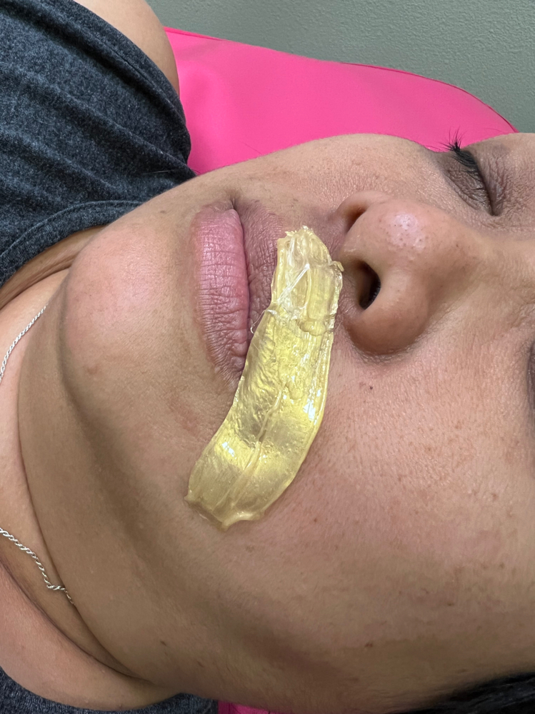 Waxing - Upper Lip