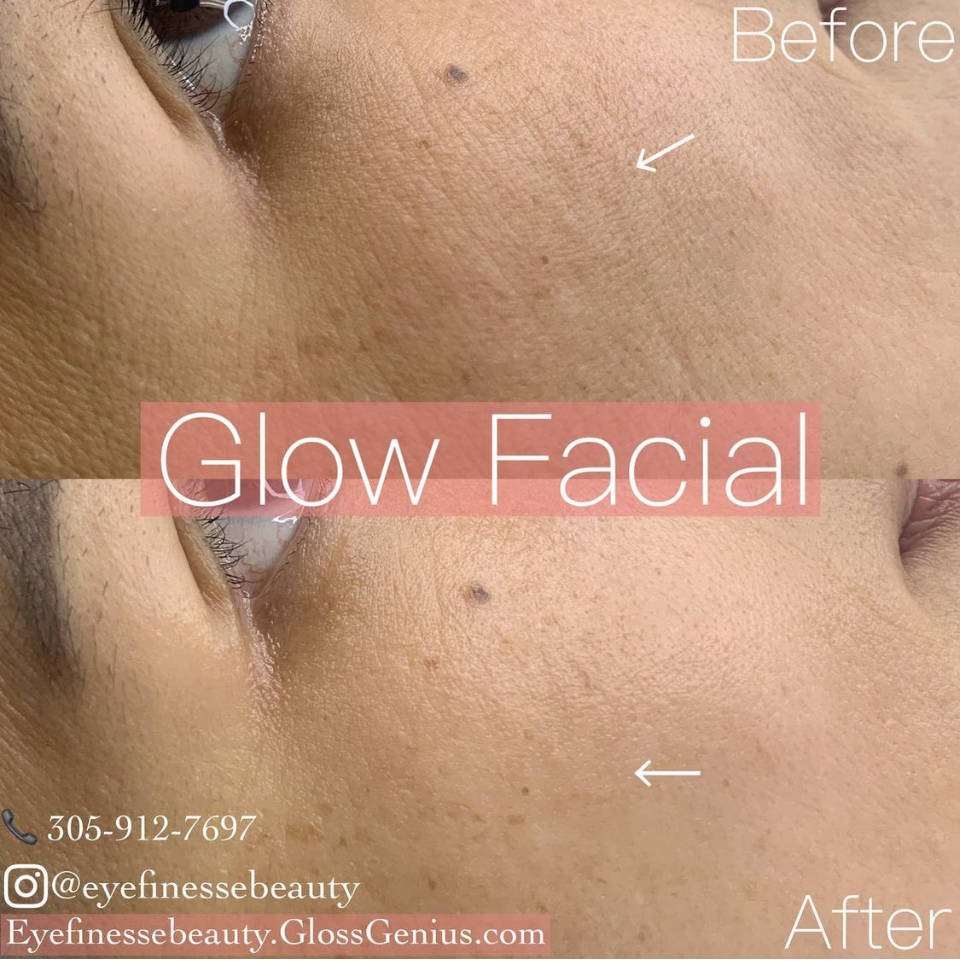 Natural Glow Facial