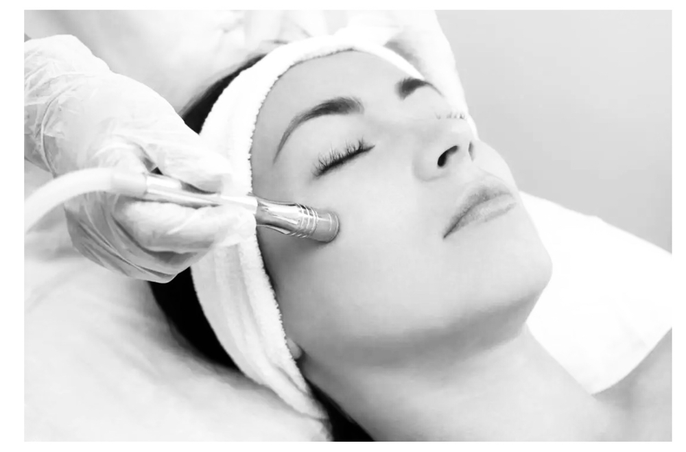 Microdermabrasion Facial