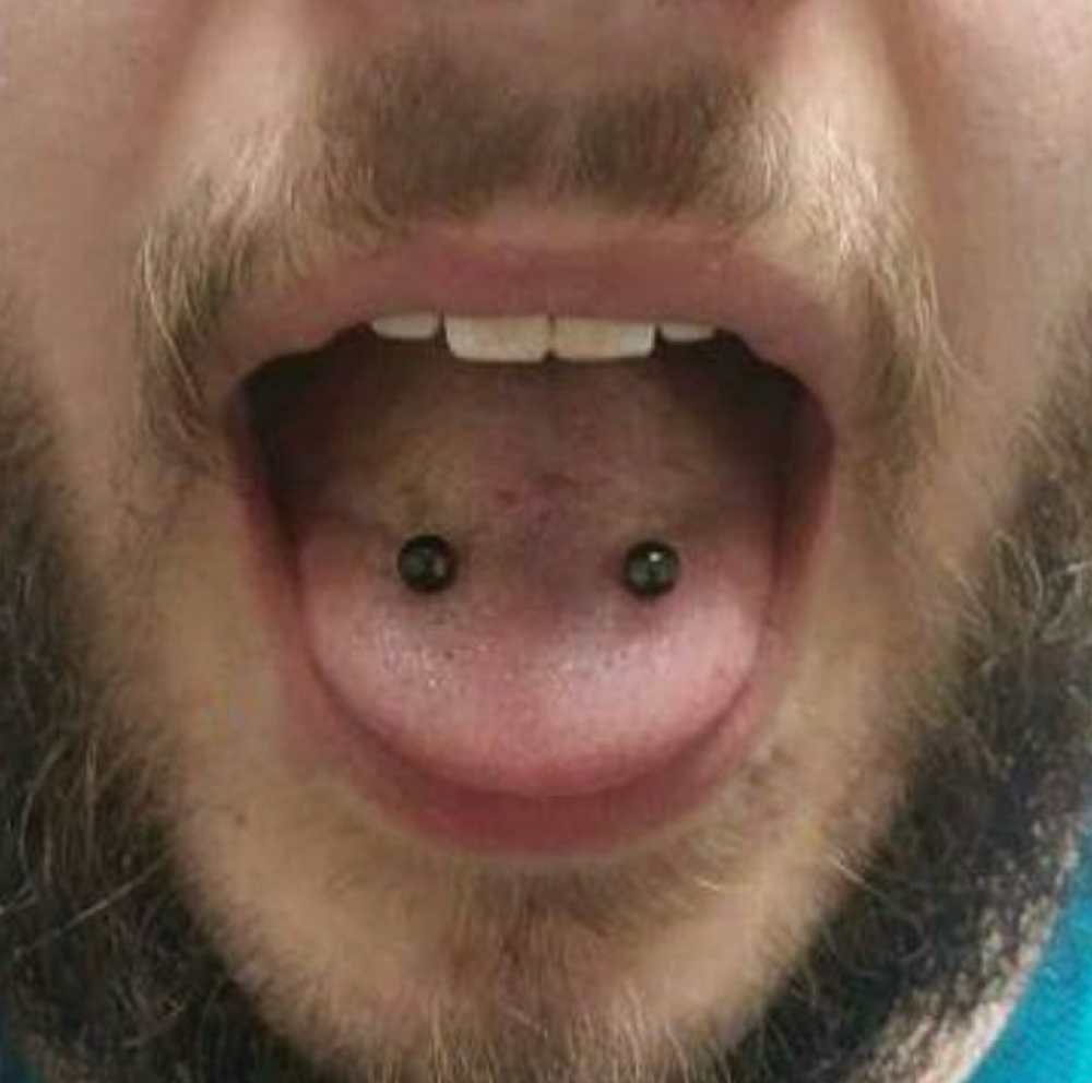 VENOM BITES at Crow & Taper in Hanover, PA