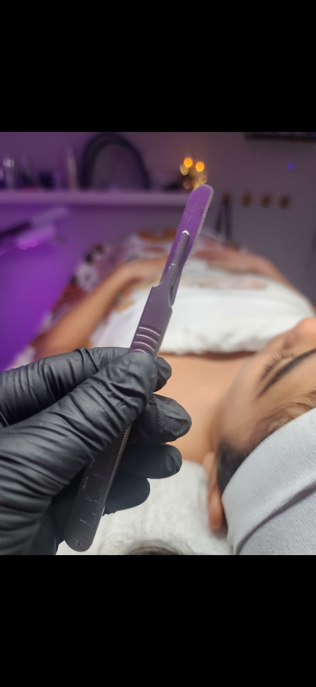 Dermaplaning at Morning Glow Esthetics in Palm Desert, CA