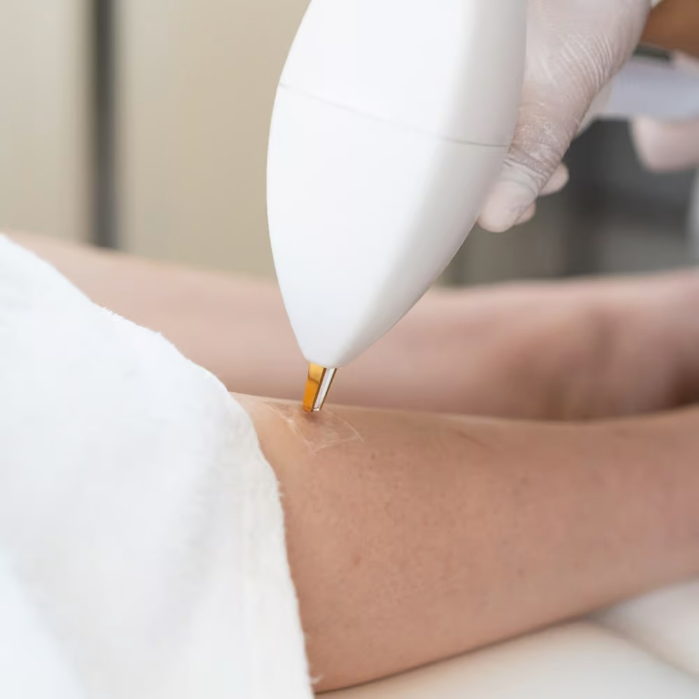 Vasculaze at Luxe Level Aesthetics in Darien, CT