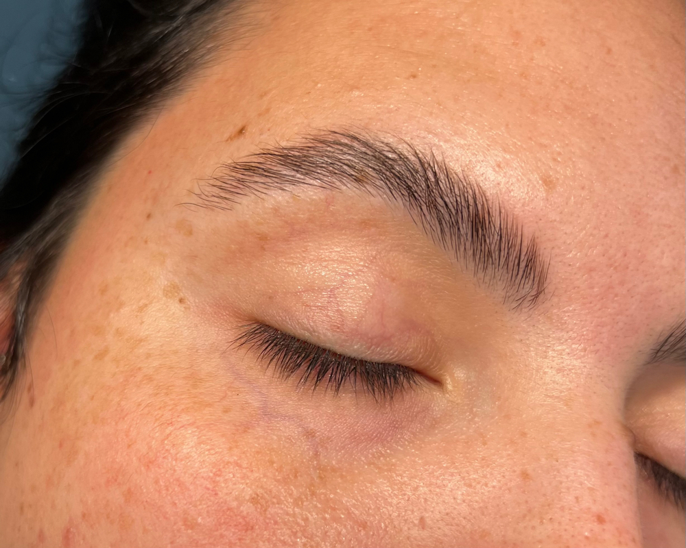 Brow Lamination