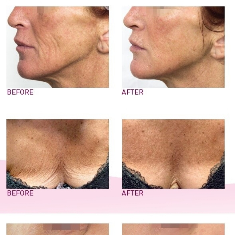 Unicorn Facial Treatment at Couture Aesthetics in Weatherford, TX