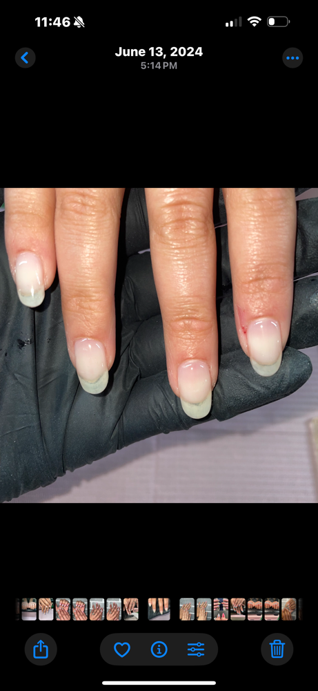 Nail Repair