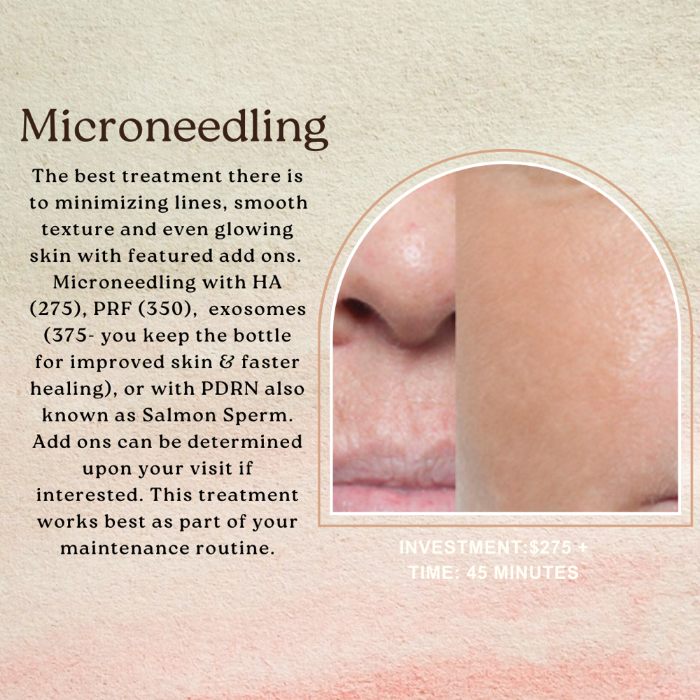 Microneedling