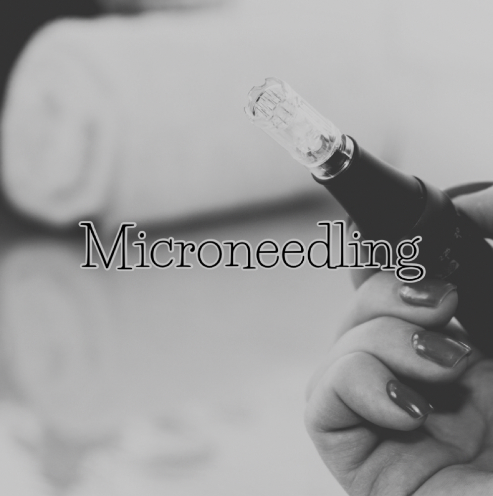 Microneedling at Viv The NP in Mont Belvieu, TX