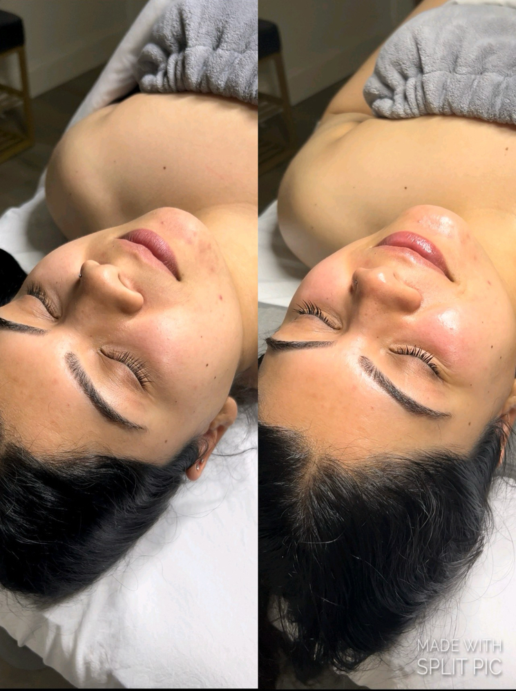 Custom Luxury Facial☁️