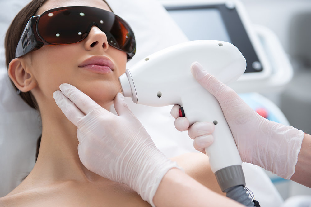 Laser Hair Removal - Small Areas X6