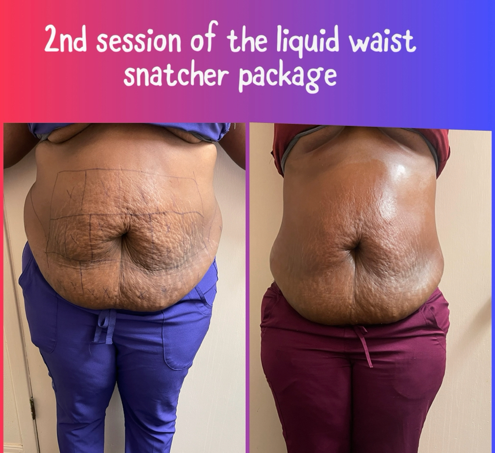 Liquid Waist Snatcher at Pure Essence Beauty & Body, LLC in Shreveport, LA