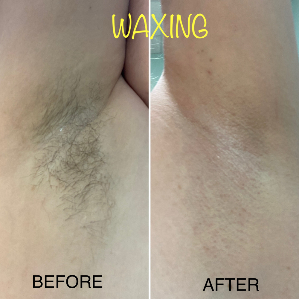 Underarms at Shea Beauty Bar in Pineville, LA