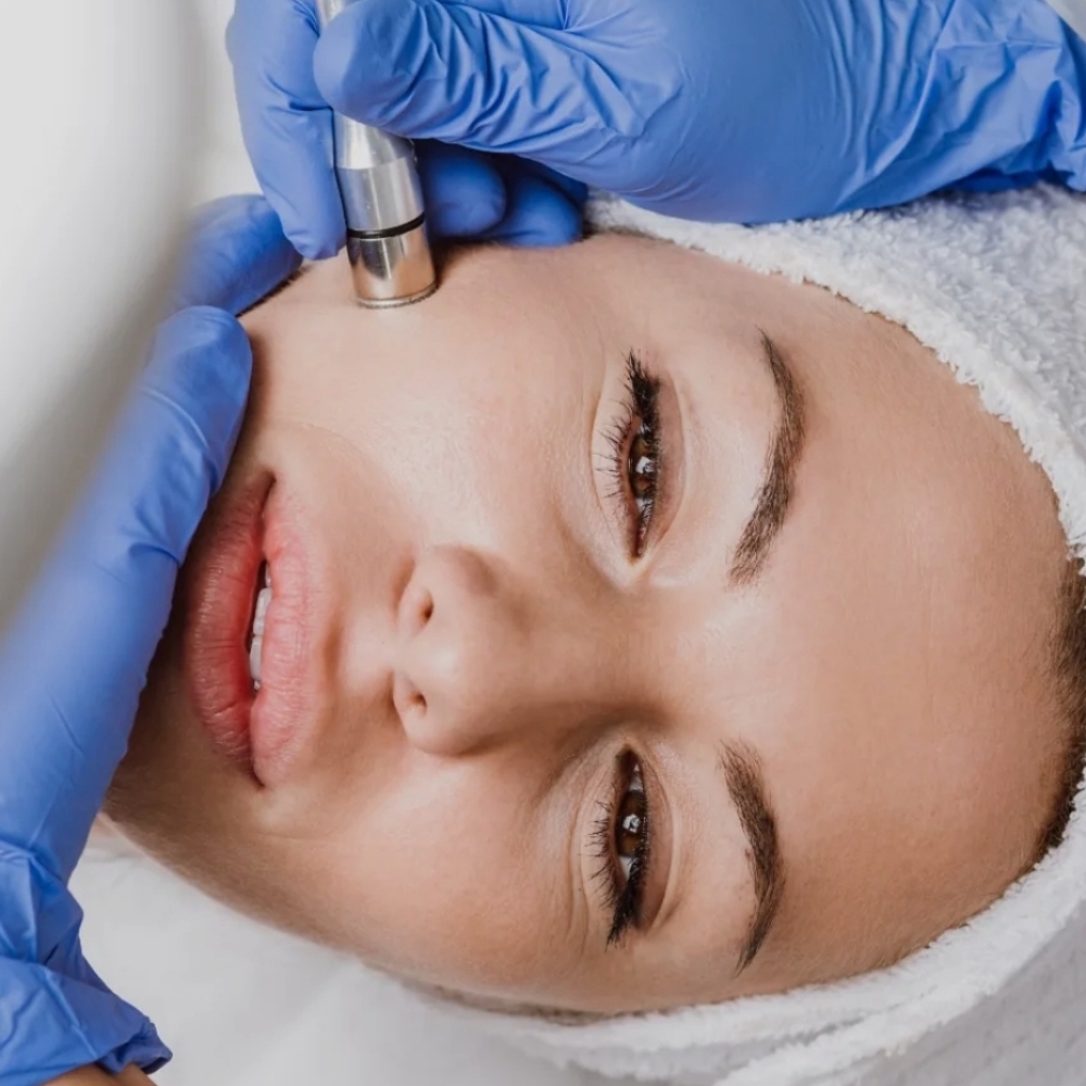 Express Microdermabrasion GLOW at let's face it by Ash in Evans, CO