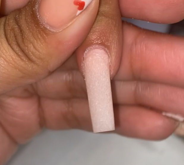 Repair Of Nail