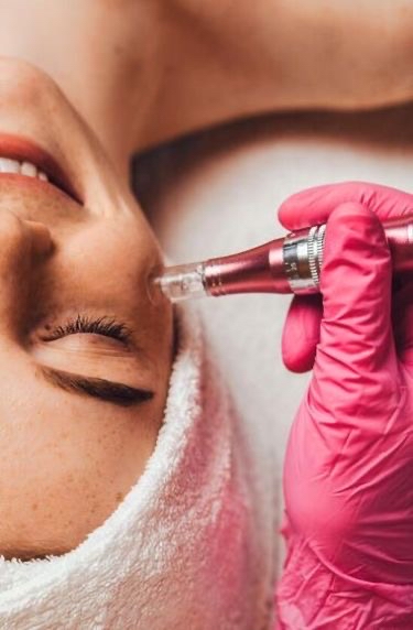 Collagen Induction Facial