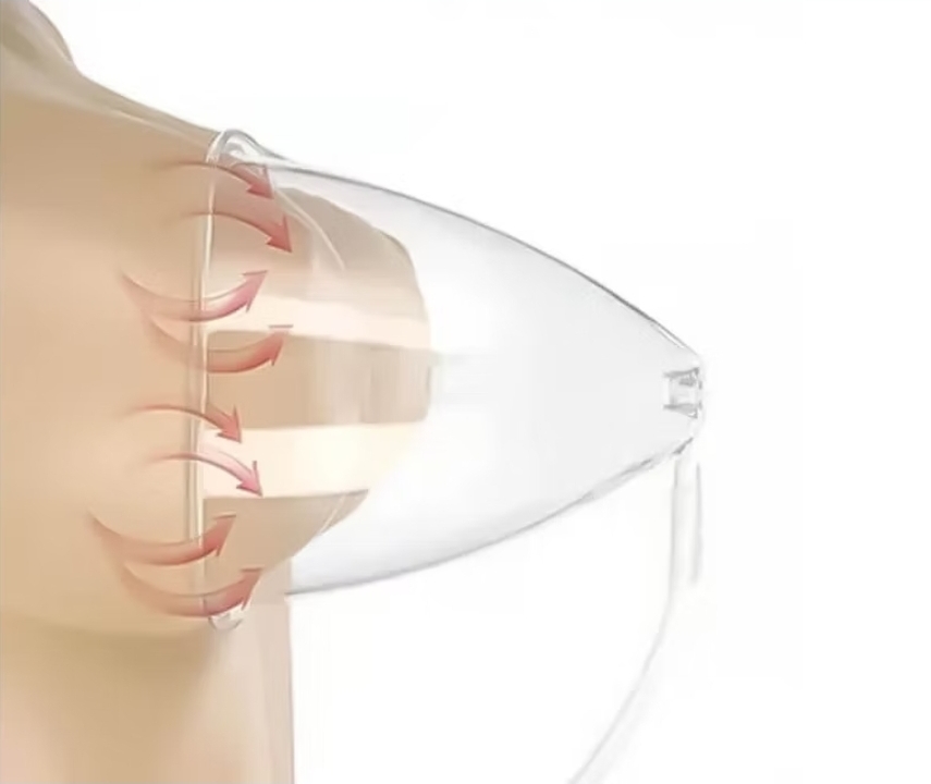 Vacuum Therapy Breast Lift at Beauty2you in Visalia, CA