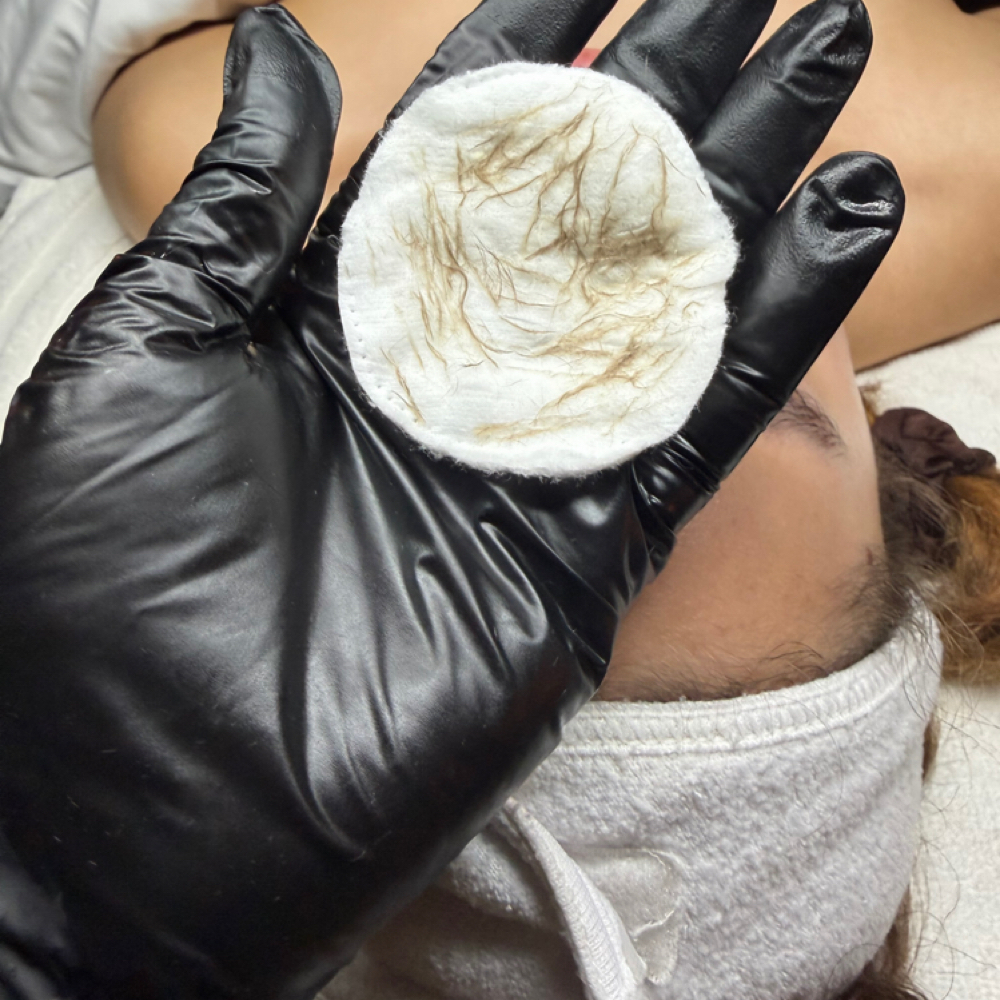 Dermaplaning  Facial  + Happy Peel