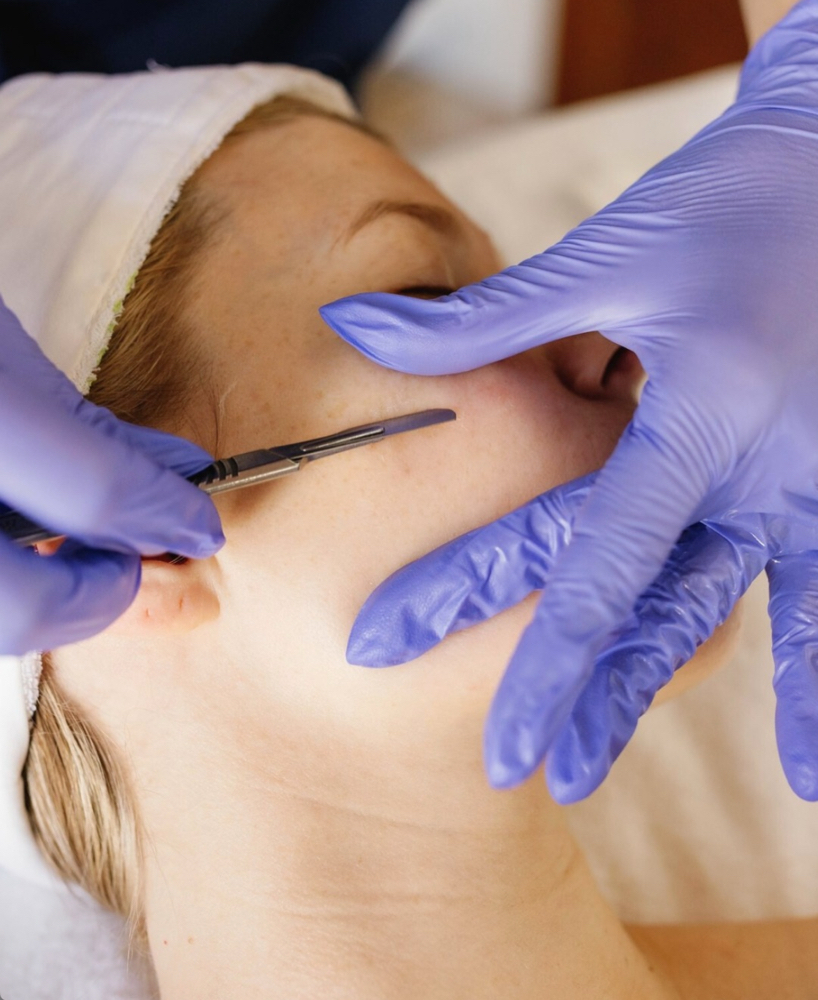 Dermaplaning  Facial  + Happy Peel