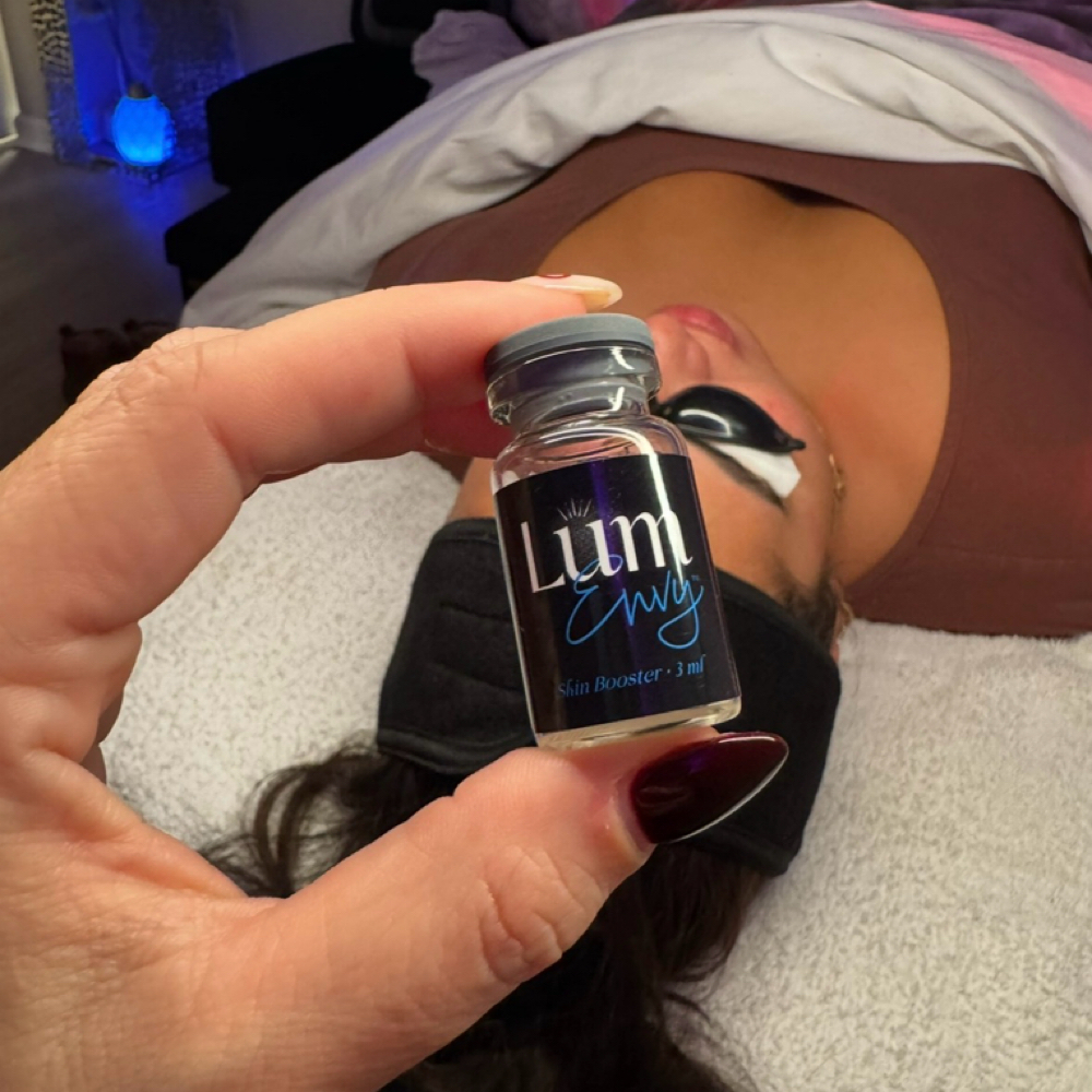 NANO NEEDLING + SALMON DNA at Esthetics By Cheynne in Massapequa, NY