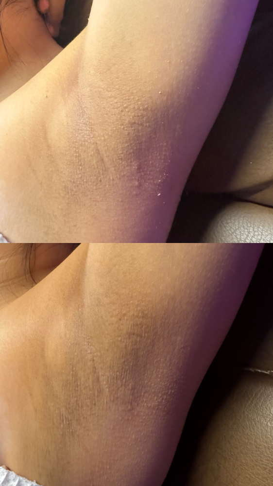 Illuminé Body Brightening Treatment