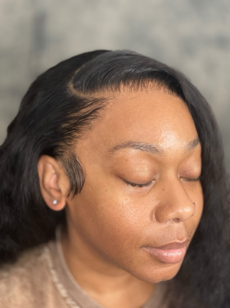 Frontal Install